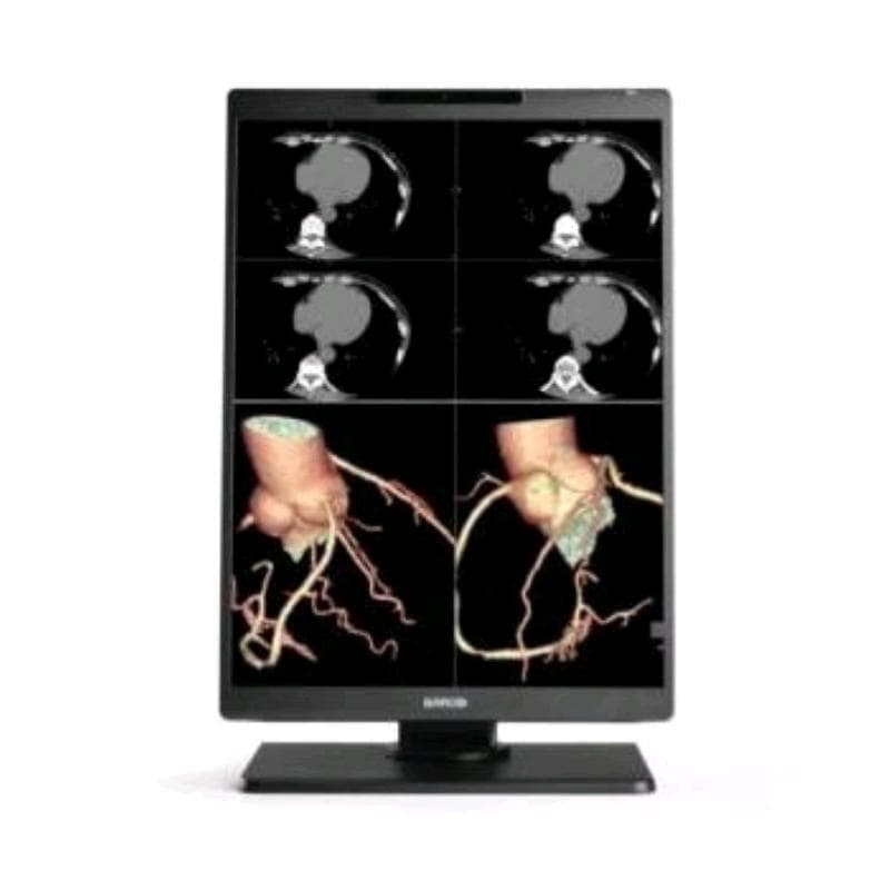 MONITOR MEDICALE 21" 3MP NIO COLOR SNES 1H1F NC EXCL